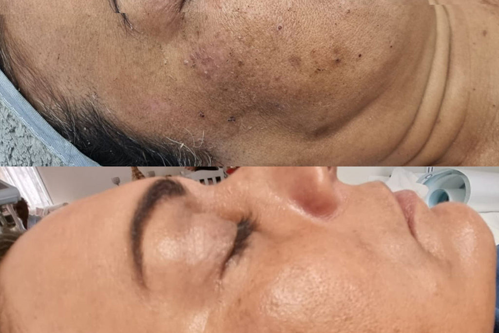 How to Treat Pigmentation: At-Home Tips + Best Clinic Treatments | That Skin Clinic