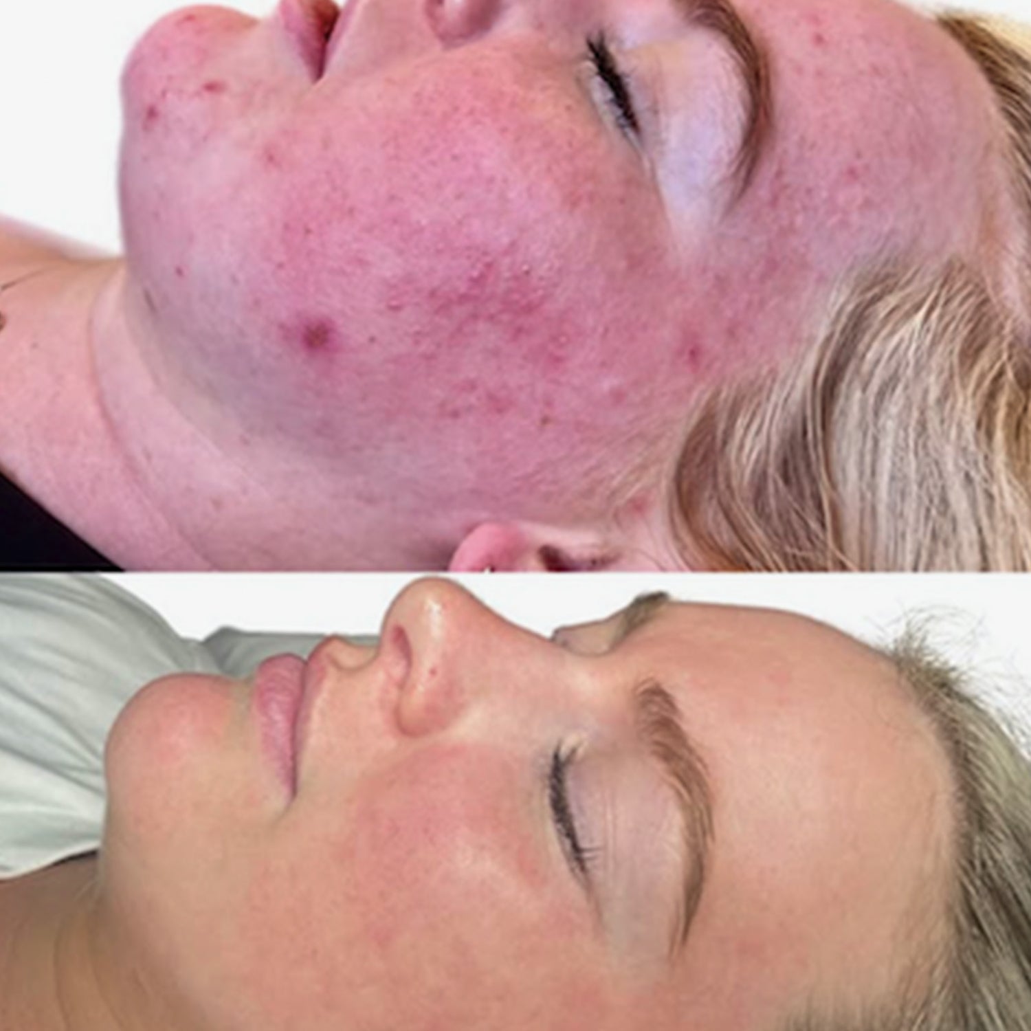 Treatment Details
