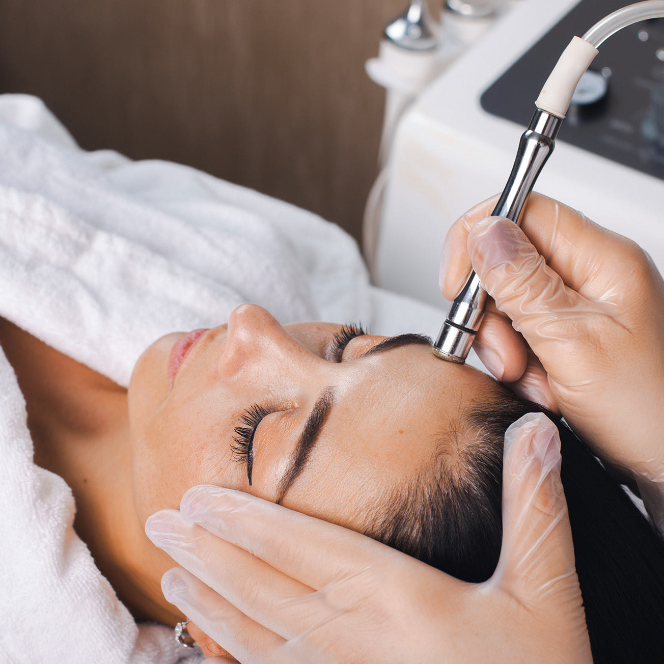 What is Microdermabrasion?