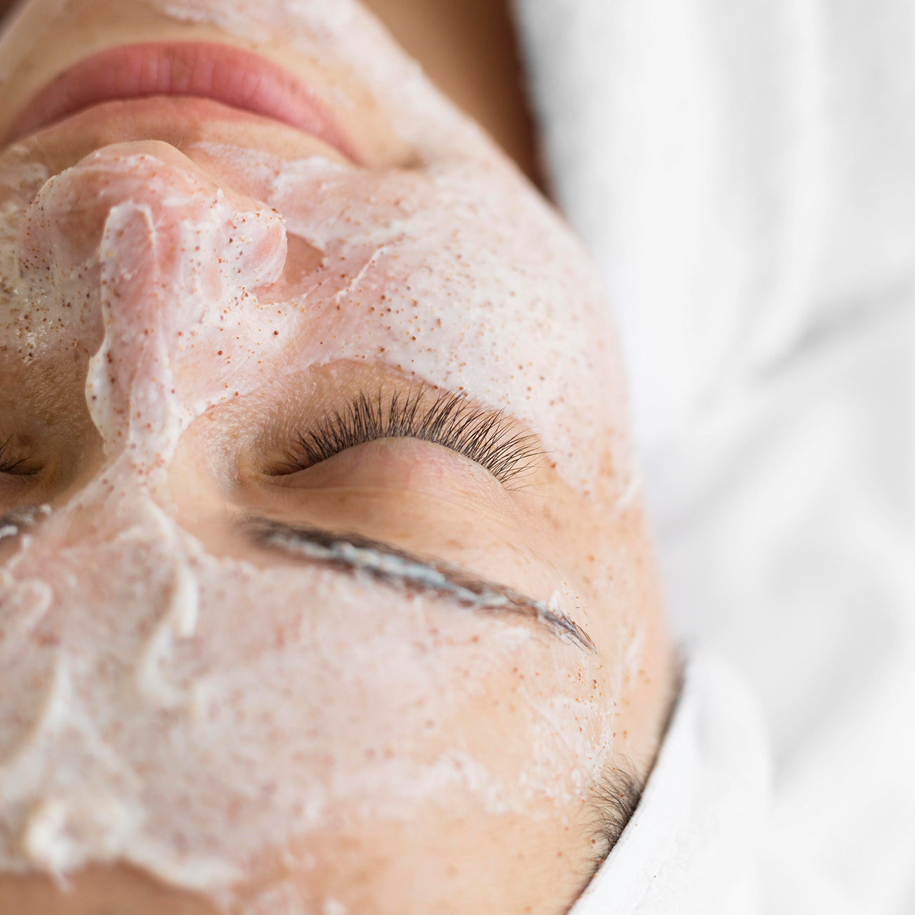Microdermabrasion Benefits