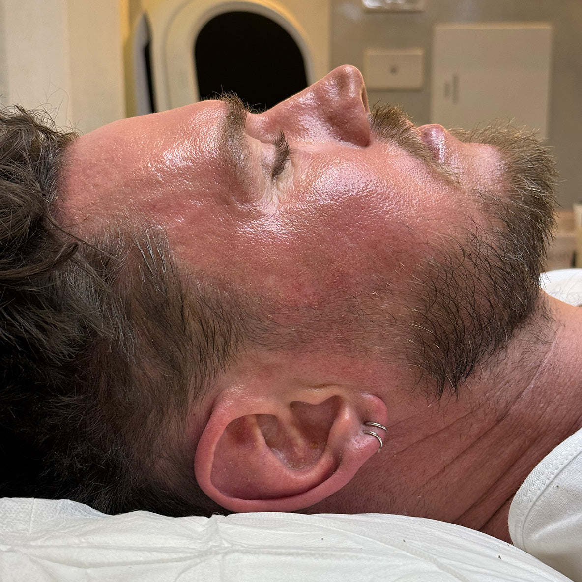 Treatments