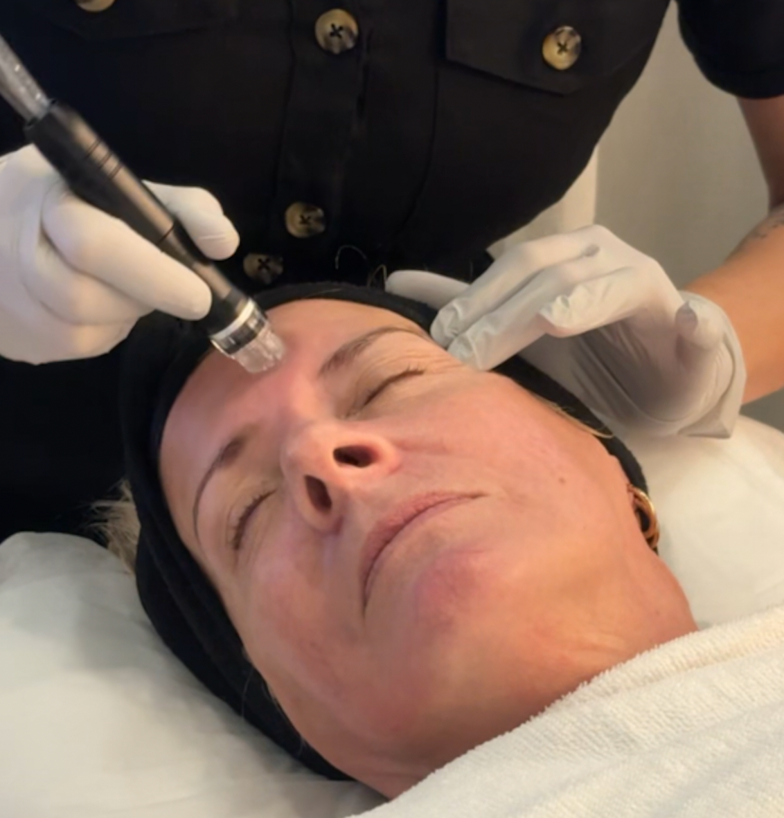 HydroFacial