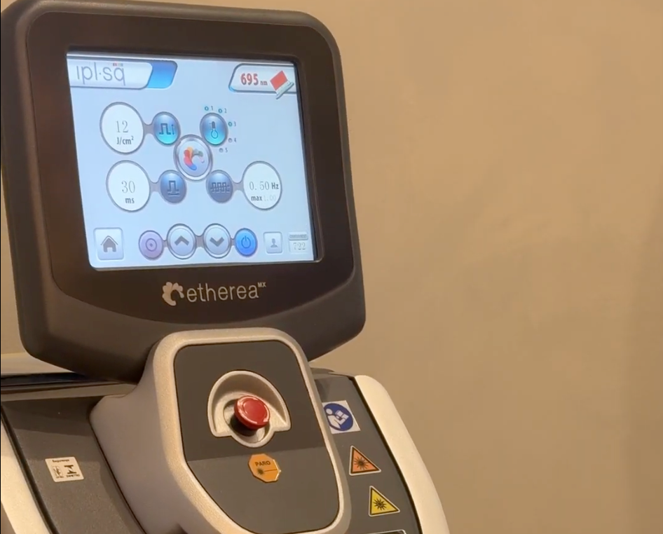 The Etherea MX Advantage