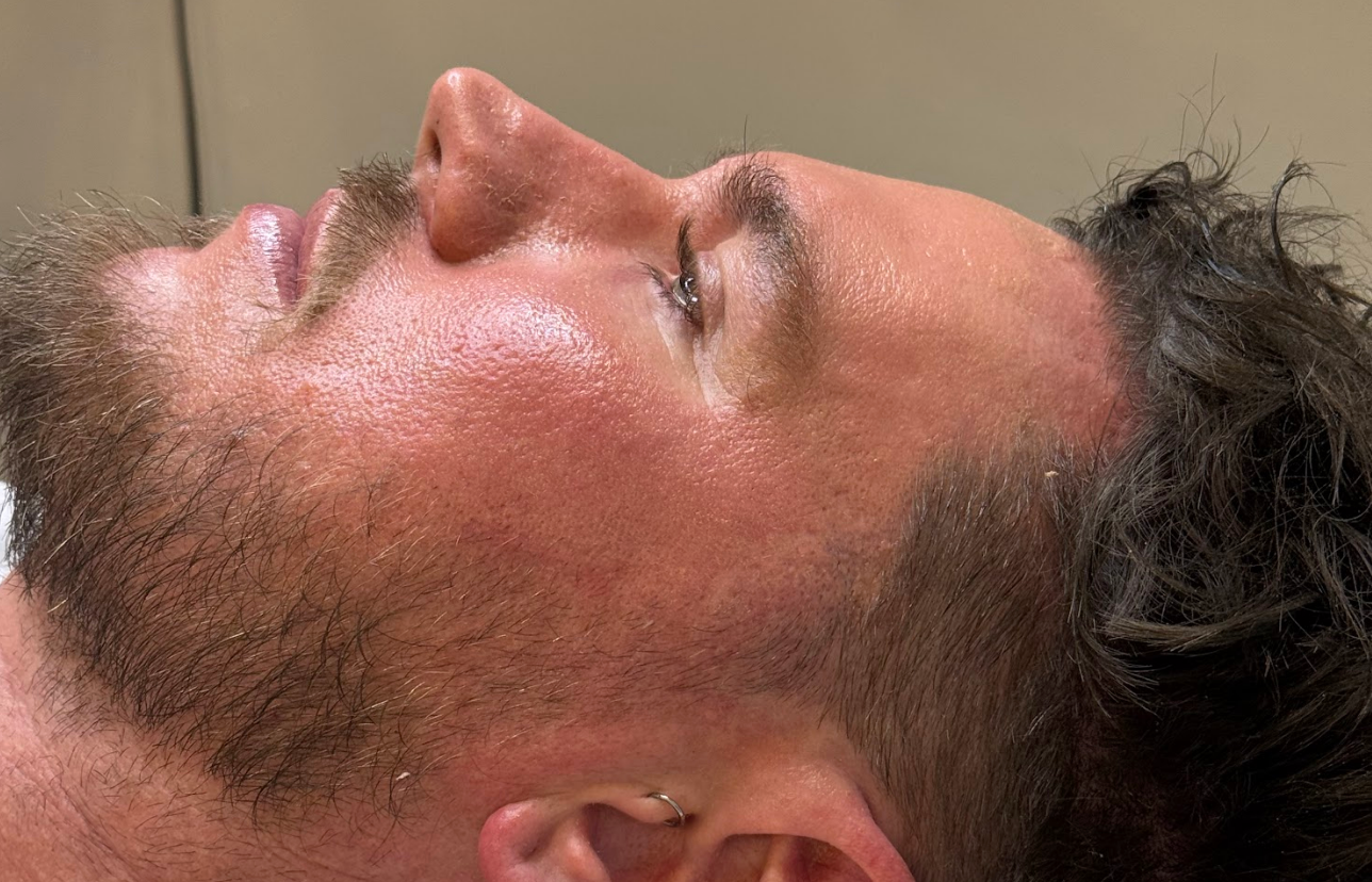 Men’s Skin Health Mooloolaba