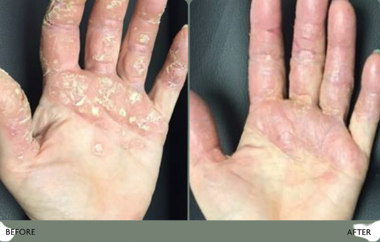 What LED can treat at our clinic?